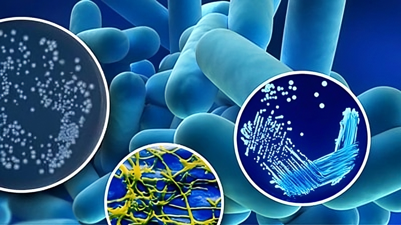diferentes muestras de bacterias al microscópico